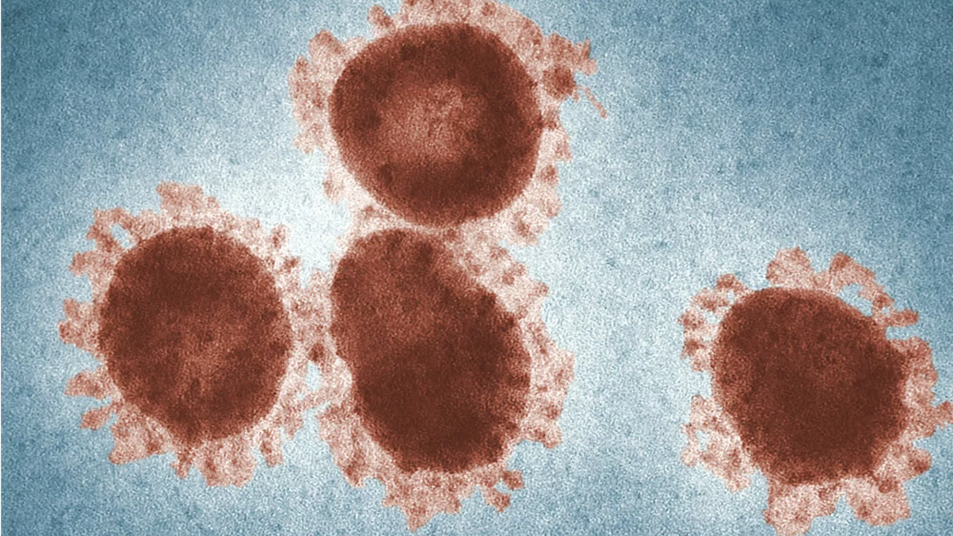 Coronavirus_1.jpg Coronavirus_1.jpg